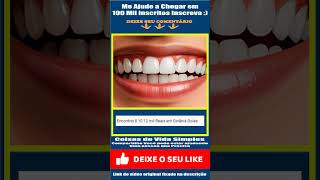 Qual Preço Prótese Dentária Protocolo 4 Pinos em Goiânia odontologia dentedosiso dentista dicas [upl. by Moyna]