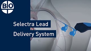 Enhancing CRT with Selectra Lead Delivery System [upl. by Eudocia]