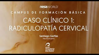 Caso clínico con NESA® Radiculopatía cervical Dr Santiago Garfias neurocirujano Ft NESA WORLD® [upl. by Ingraham]