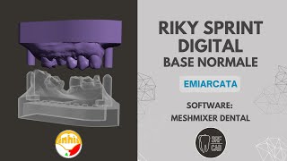 MESHMIXER DENTAL INHIO RIKY SPRINT DIGITAL BASE EMIARCATA INTRAORAL SCAN EXOCAD 3SHAPE [upl. by Starlin]