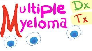 Multiple Myeloma Diagnosis and Treatment [upl. by Reuben]