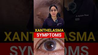 Most Common Symptoms Xanthelasma [upl. by Madelene]