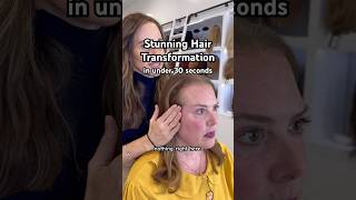 gorgeous face gorgeous frame 💗 hairtopper recedinghairline hairline tutorial transformation [upl. by Navy]