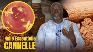 Bienfaits Huile Essentielle de Cannelle  Pr Ousmane Ndiaye  LansarrTV [upl. by Lassiter]