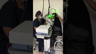 Retinal Laser Surgery Barrage laser in 2 minutes [upl. by Dulcle467]