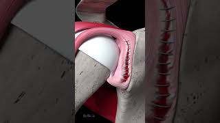 Shoulder Labrum Tear Repair Animation [upl. by Aronos]