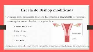 Escala de Bishop  você já utilizou [upl. by Amble947]