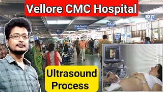 Vellore CMC Hospital Ultrasound Process  Ultrasound Kaise Hota Hai  TVS Scan Kya Hota Hai [upl. by Joletta]