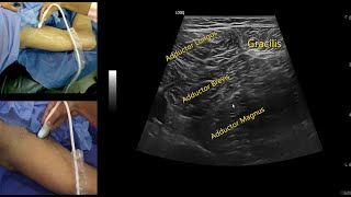 The Ultimate MSK Ultrasound Atlas [upl. by Llij]