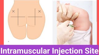 Intramuscular Injection Sites [upl. by Yardna]