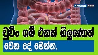 චුවිං ගම් එකක් ගිලුණොත් මොකද වෙන්නෙ  What happen to a swallowing chewing gum [upl. by Sobel304]