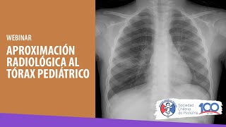 WEBINAR quotAPROXIMACIÓN RADIOLÓGICA AL TÓRAX PEDIÁTRICOquot [upl. by Leuas199]