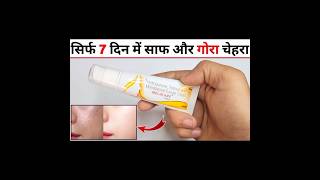 Melacare Cream Review in Hindi मेलाकेयर क्रीम के फायदे नुकसान उपयोग [upl. by Gardy943]