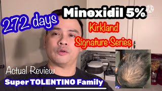 Minoxidil 5 Kirkland Signature 272 DAYS 😱 REVIEW￼ [upl. by Archibald]