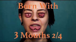 Born With Three Mouths 24  Girl With Split Tongue [upl. by Ytissahc]