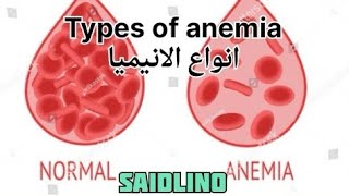 انواع الأنيميا شرح للطاقم الطبي Types of anemia [upl. by Browne287]