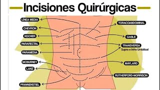 🔴 INCISIONES QUIRURGICAS ABDOMINALES [upl. by Mills]