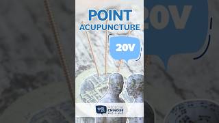 POINT D’ACUPUNCTURE  20V  Pi Shu acupuncture acupuncturepoints medecinechinoise [upl. by Orva]