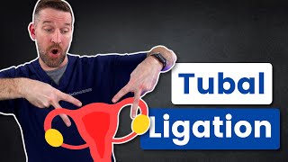 Tubal Ligation VS Longterm Contraception [upl. by Lebatsirc]