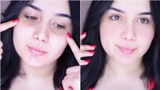 طريقة التخلص سريعا من الهالات السوداء طبيعيا  Bye Bye Dark Circles [upl. by Akire274]