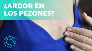 DERMATITIS en el PEZÓN 🔥 Remedios Caseros para la Dermatitis en el Pezón [upl. by Leahcimrej]