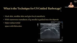 How To Treat Calcific Rotator Cuff Tendinopathy Ultrasound Guided Barbotage and PRP Injection [upl. by Yenffad]