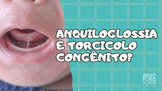 Existe relação entre anquiloglossia e torcicolo congênito RESPONDENDO PERGUNTAS [upl. by Vickie]