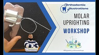 ep 25  orthodontic molar uprighting mechanics  wire bending workshop [upl. by Trebo]