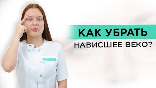 Как убрать НАВИСШЕЕ ВЕКО Методики по устранению [upl. by Ennylhsa408]