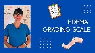 Edema Grading Scale shorts [upl. by Trefler]