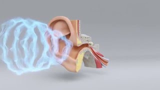 Explore the Science of Hearing Loss  MiracleEar Hearing Center [upl. by Jaymee211]