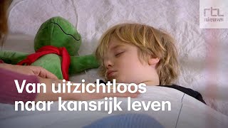 Hersenhelft van Benjamin 4 uitgeschakeld tegen epilepsie [upl. by Ahsircal]