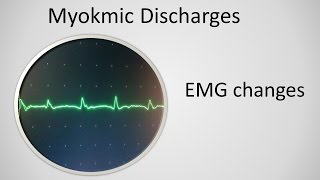 Myokymia on EMG [upl. by Eirellam]