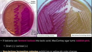 MacConkey Agar [upl. by Melvyn]