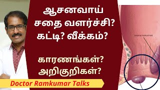 ஆசன வாய் பகுதியில் சதை வளர்ச்சி வீக்கம் கட்டிகள் வர காரணங்கள் amp அறிகுறிகள் என்ன  ANUS SWELLING [upl. by Riedel]