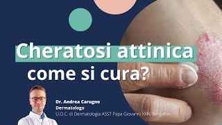 Cheratosi attinica come si cura  DermaPoint [upl. by Imeon]