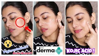 Kojic Acid For Pigmentation amp Acne Scars  The Derma Co 2 Kojic Acid Serum  Cream  Arpita Ghoshal [upl. by Thorfinn]