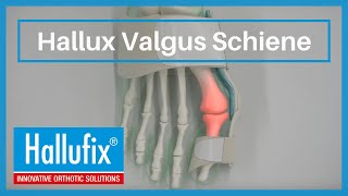 Hallufix® Hallux Valgus Schiene [upl. by Joshuah861]