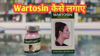 Wartosin Wart Remover l Wartosin kaise Lagaye l Price  Uses in Hindi l How to Use l [upl. by Boni]