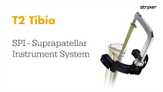 Stryker Trauma amp Extremities  Suprapatellar Nailing  T2 Tibia SPI Animation [upl. by Nodnahs]