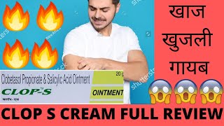 CLOP S Cream Full Review Effects and Side Effects Best for Fungal skin Infection खाज खुजली गायब 🔥😃😎👍 [upl. by Kavanaugh]