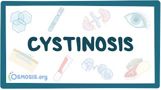 Cystinosis  causes symptoms diagnosis treatment pathology [upl. by Convery]