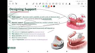 prosthodontics lec support for the distal extension denture base مرحلة رابعة طب اسنان [upl. by Camey156]