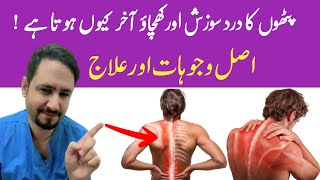 Myalgia Muscle Pain Treatment In Urdu Hindi  Dr Irfan Azeem [upl. by Losyram955]