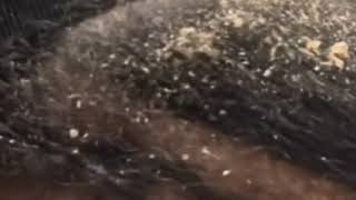 Dandruff Scratching head picking video [upl. by Theurer158]