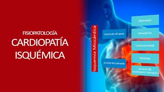 Fisiopatología  Isquemia miocardica [upl. by Nikaniki]