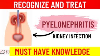 What is Pyelonephritis  All you need to know  Causes  Symptoms  Diagnosis  Treatment [upl. by Camroc]