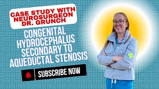 Case Study 145  Congenital Hydrocephalus secondary to aqueductal stenosis  explained by Dr Grunch [upl. by Akima]