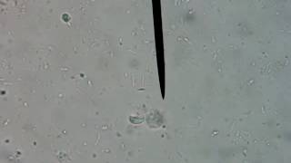 Giardia in a Dog Stool Sample Found by Direct Fecal Smear 40X [upl. by Enialehs]