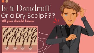 Is It Dandruff Or A Dry Scalp Heres What You Need To Know [upl. by Etteval]